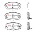 DBA 18-23 Hyundai Kona (w/A/T / 305mm Front Rotor) AWD Front SSEV Street Series Brake Pads