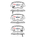 DBA 17-20 Hyundai Elantra (w/280mm Front Rotor) 2.0L Front SSEV Street Series Brake Pads